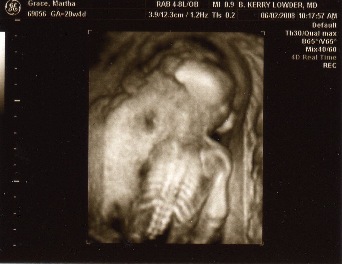 [Ultrasound+-+Baby#3+20Wk024.jpg]