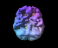 Imagem de um cerebro TDAH em concentracao