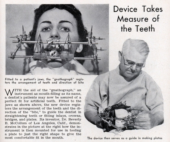 [med_device_measure_teeth.jpg]