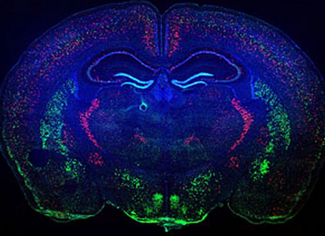 [cerebro+mapas+genes.jpg]