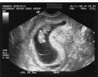 [01.11+-+Ultrasound+Baby+A+2.jpg]