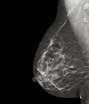 [mamografia_mundo.jpg]