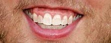 [teeth-jon-heder-400a071807.jpg]