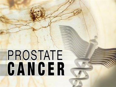 El càncer de pròstata (CP) és el segon tumor més freqüent entre els homes i la tercera causa de mor