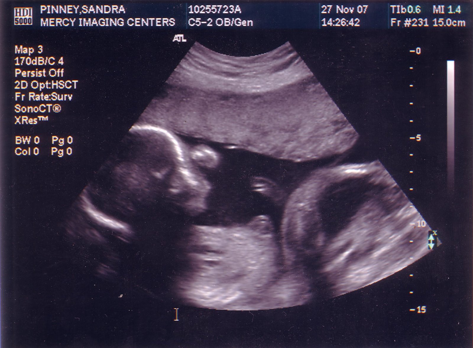 [Baby+Ultrasound+2007.JPG]