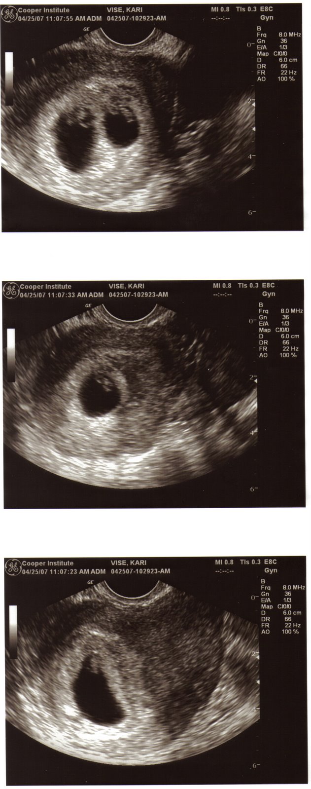 [7+week+embryos.jpg]