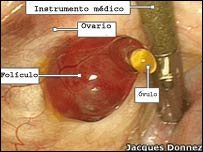 [2-La+ovulación+se+lleva+a+cabo+en+los+tejidos+de+la+superficie+del+ovario.jpg]