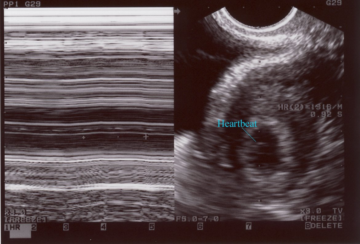 [ultrasound2nn.jpg]