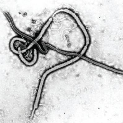 [Ebola_virus.jpg]