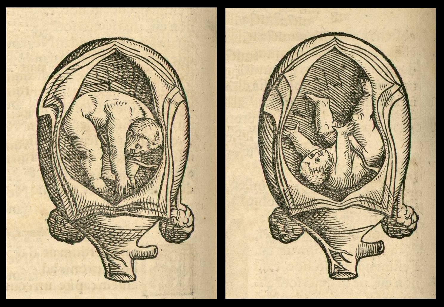 foetal positions - anatomical woodcut