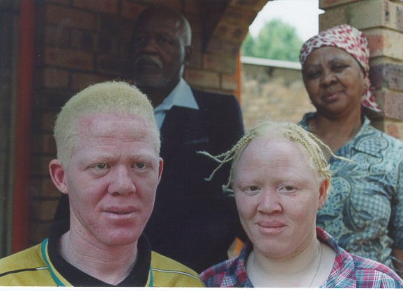 [albinos.jpg]