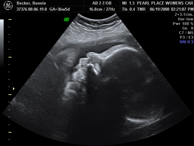 [2008_06_19_ultrasound5.JPG]