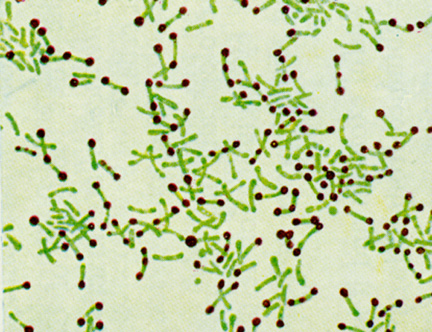 [corynebacterium.jpg]