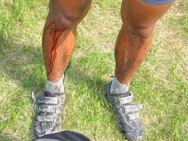 [7+Worked+so+hard+my+legs+bleed!.jpg]
