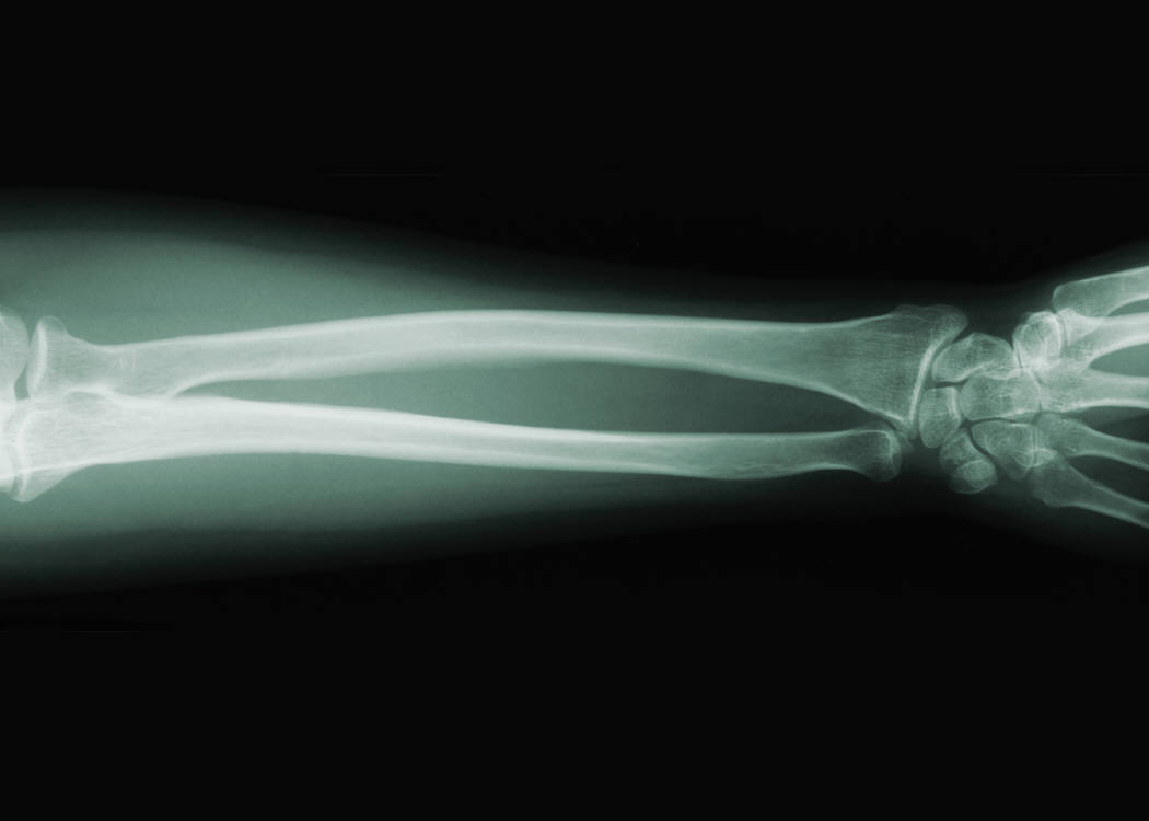 [X-ray-arm[1].jpg]