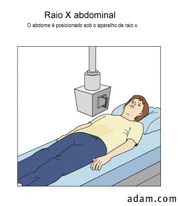 [rx+abdominal.jpg]