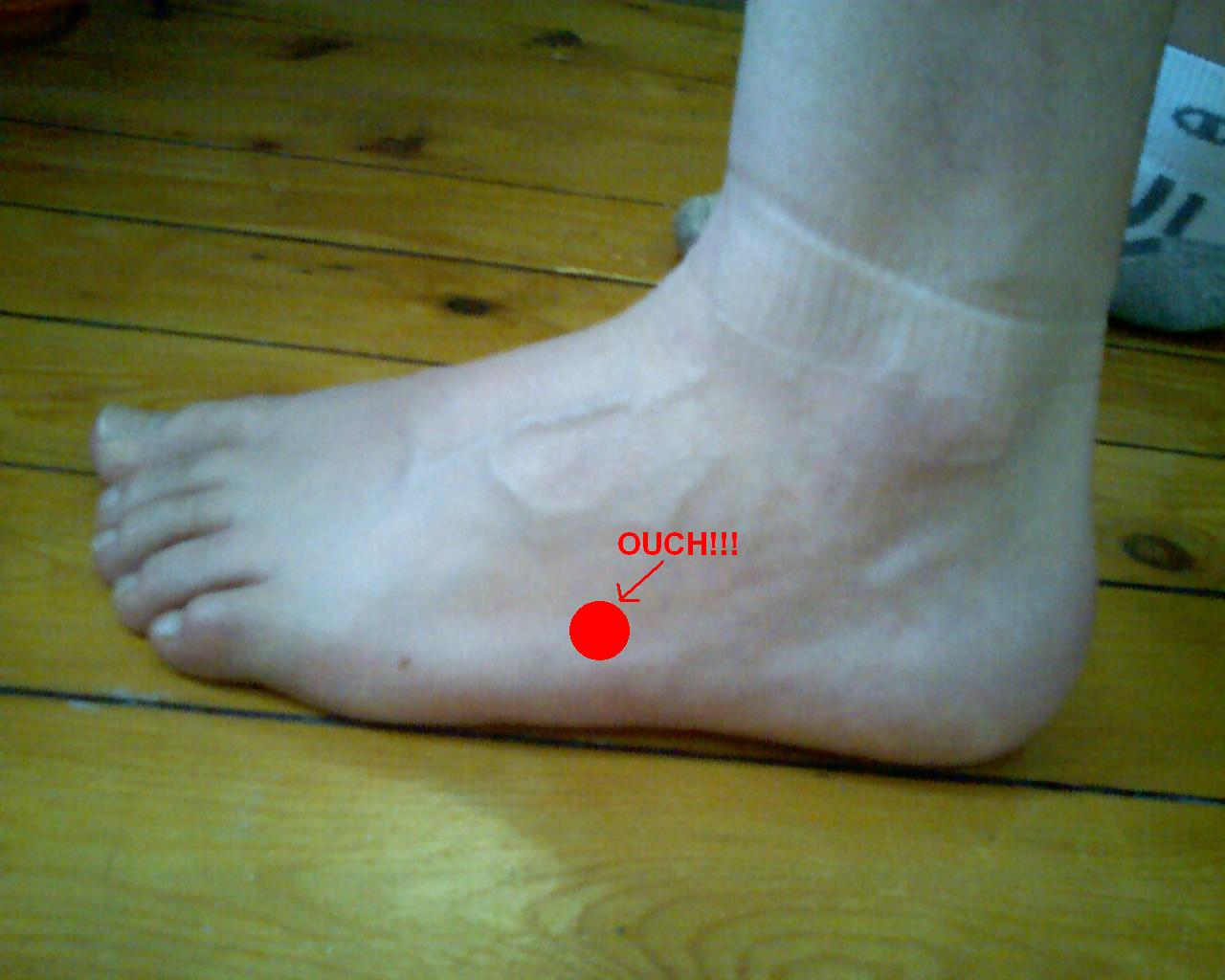 [My+foot.jpg]
