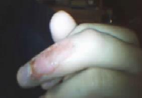 [my+finger+4.JPG]