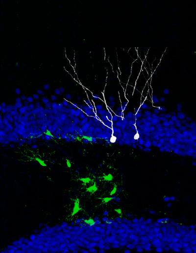 [neural+stem+cells.jpg]