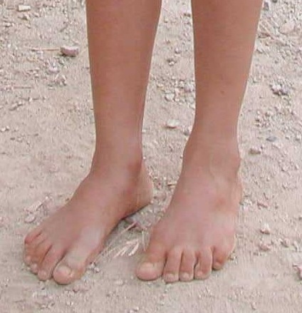 [Bare_feet.JPG]