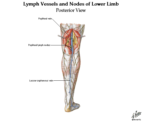 [CLL+Lumph+nodes+leg.gif]