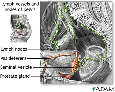 [abdominal+lymph+nodes.jpg]