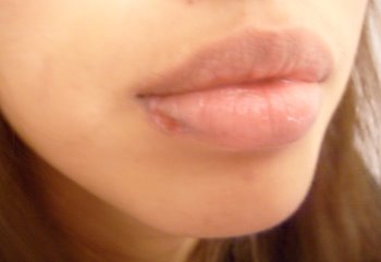 [lips.JPG]