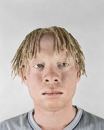 [albino-africans03.jpg]